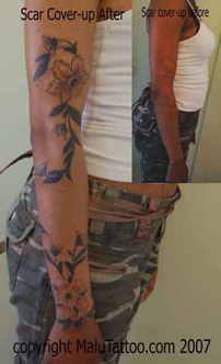 arm tattoo scar cover-up